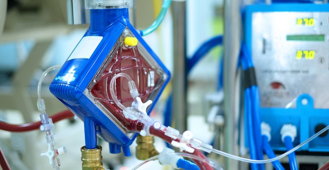 Intervenție critică pentru Mircea Lucescu. Ce presupune procedura ECMO și cine este medicul care îl operează